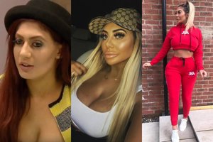 Neatpažįstamai „Instagram“ žvaigždę pakeitusį chirurgą siūlo paduoti į teismą