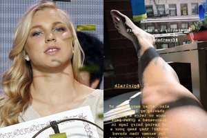 Plaukuotas kojas parodžiusi Rūta Meilutytė prisidėjo prie feministinio judėjimo