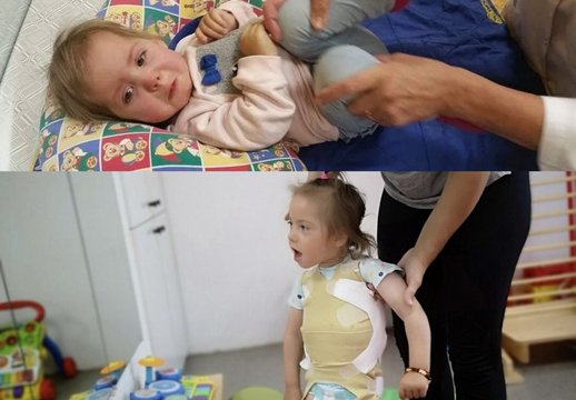 Trys sunkios būklės vaikučiai iš Lietuvos kaunasi už teisę sveikti: reikia palaikymo