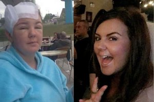 Kol gydytojai juokėsi iš simptomų, moteris apako viena akimi