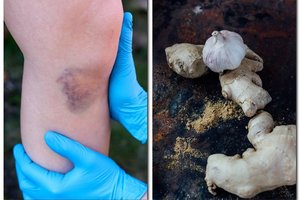 Česnakas ir imbieras jūsų organizmui gali sukelti netikėtą poveikį