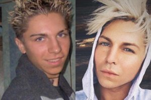 Lietuviškasis Kenas parodė kaip atrodė prieš plastines operacijas