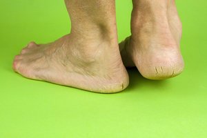 Apžiūrėkite pėdas: nagai ir pėdų oda išduos didžiausias jūsų problemas