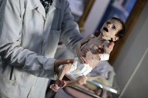Pasaulį apskriejo šokiruojančios kūdikio nuotraukos: priežastis jus priblokš