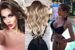 Po rizikingos 150-osios operacijos skandalingoji Pixee Fox – medikų rankose