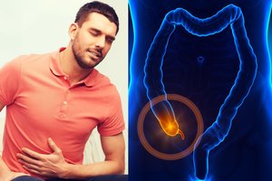 Jums išoperavo apendiksą? Mokslininkai turi puikių žinių