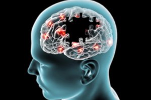 Prastos naujienos: pastebėjo ryšį tarp apendikso ir Parkinsono ligos