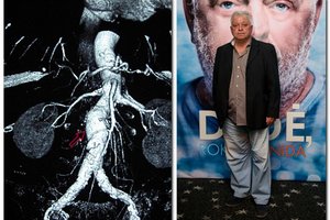 Arūną Storpirštį užklupo klastinga liga: pirmasis simptomas dažniausiai būna staigi mirtis