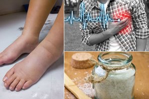 Tinstančios kojos gali pranašauti rimtas bėdas, o jų išvengti labai paprasta 