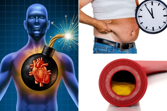 Ši gyvybei pavojinga būklė nustatoma 9 iš 10 žmonių, bet tik retas žino apie tai