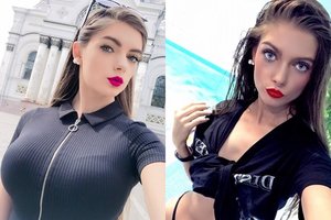 Krūtinę koreguojanti darbui per graži Emma sulaukė aštrios kritikos