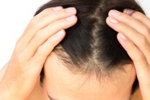 Plaukų retėjimas – ne tik vyresnių vyrų problema: ką daryti?
