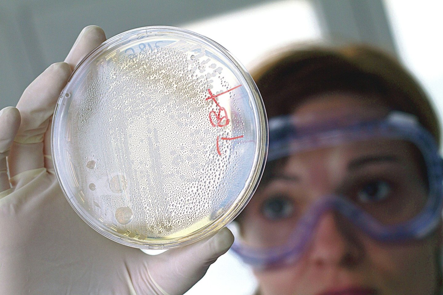 Tyrėjai nuolat ieško mikroorganizmų, iš kurių galėtų sukurti naujų antibiotikų, tačiau šis procesas yra lėtas ir brangus, o atsparių infekcijų vis daugėja.<br>„Reuters“/„Scanpix“ nuotr.