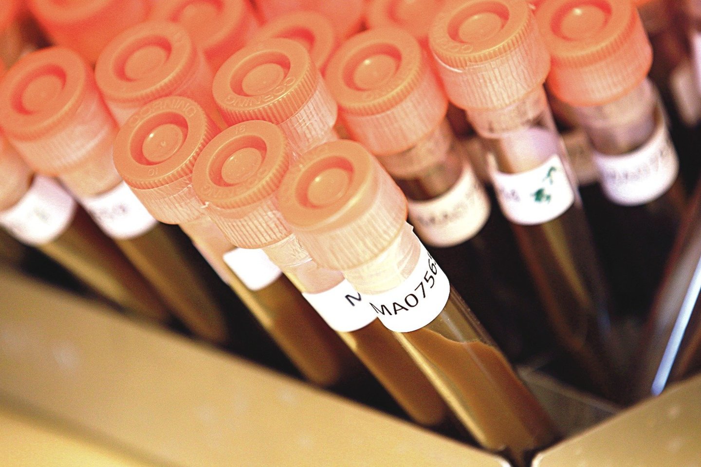 Įvairios laboratorijos pasaulyje prašo žmonių pagalbos tyrimuose. Iš viso pasaulio atsiųstuose mėginiuose randama įdomių ir dar neištirtų bakterijų.<br>„Reuters“/„Scanpix“ nuotr.