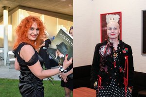 Po sudėtingos onkologinės operacijos Jūratė Rekevičiūtė atvirai – apie krūties šalinimą ir savijautą