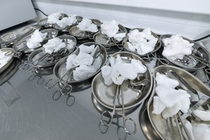 Kyšį paėmusi ginekologė po operacijos pinigus grąžino – į pacientę bijojo net pažiūrėti