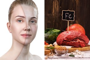 7 požymiai, bylojantys, kad jūsų organizmui trūksta geležies