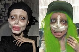 Angelinos Jolie mėgdžiotoja ryžosi pavojingai operacijai