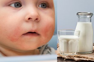 Alergija maistui gali atsirasti ir dėl vieno vitamino trūkumo