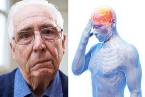 Lietuvių pamėgtas produktas gali labai padidinti insulto ir silpnaprotystės riziką