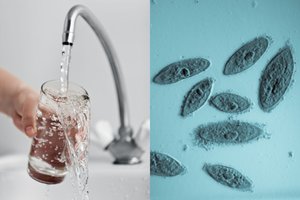 Moteris mirė, bandydama vandeniu praplauti dėl sinusito užgulusią nosį