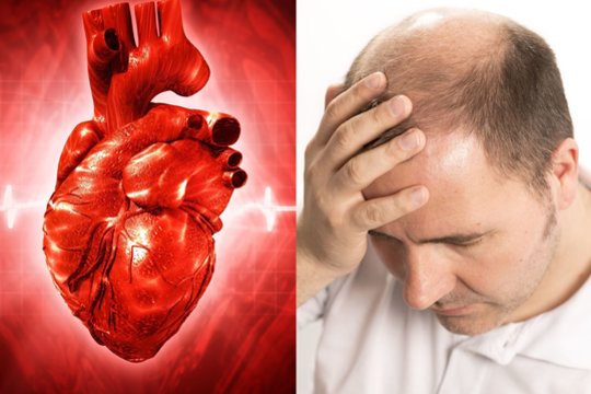 Nepatikėsite, kas didina širdies ligų riziką labiau nei antsvoris