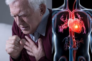 Įsidėmėkite šiuos 7 tyliojo infarkto simptomus: tai gali išgelbėti gyvybę 