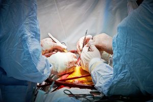 Dėl neužbaigto įstatymo Ukrainoje stabdomos organų transplantacijos