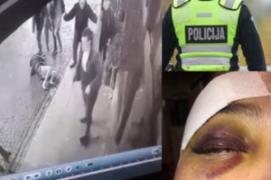 Žinomas pareigūnas apie paviešintą smūgį merginai: parodytų visą įrašą, kitaip kalbėtumėte