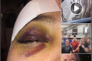 Paaiškėjo daugiau detalių apie galimą dziudo imtynininko išpuolį: yra ir daugiau nukentėjusiųjų