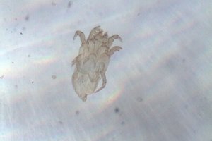 Nematomi mūsų lovos gyventojai