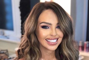 Rūgštimi apipiltas modelis Katie Piper parodė, kaip atrodo gijimo procesas