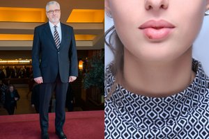 Daktaras A. Unikauskas patarė, ką valgyti ir ko vengti, jeigu pasireiškė pūslelinė