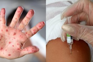 Lietuvoje toliau plinta grėsmingas užkratas: neaplenkė ir Kauno apskrities