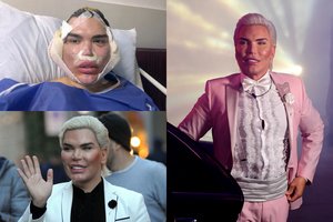 Gyva lėle Kenu vadinamam brazilui – nauja nosis iš jo paties šonkaulio