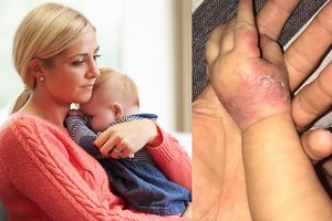 Vilnietė pasipiktino ligoninės personalo aplaidumu: „Vaikas klykė nenormaliu balsu“