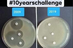 Medikų nuotraukose – įspėjimas apie visiems gresiantį didelį pavojų