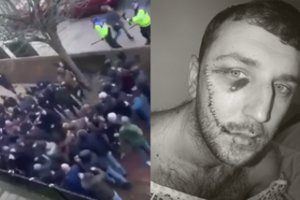 Anglijos policija šokiruota: tokio smurto proveržio tarp futbolo aistruolių seniai nematė