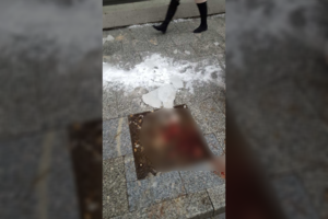 Vilniaus centre kraupiai sužalota moteris: ant galvos užkrito ledo luitas