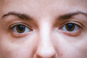 Vargina pajuodę paakiai? Kasdien plaukite nosį!