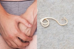 Santaros klinikų medikai apstulbo: vaikino sėklidėse rado 13 cm ilgio kirmėlę
