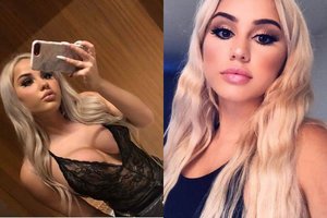 Instagramo žvaigždei pasimaišė protas: per plauką neužmušė žmogaus