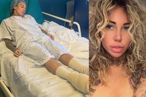 Plastinių operacijų maniakė ryžosi procedūrai, peržengiančiai visas ribas