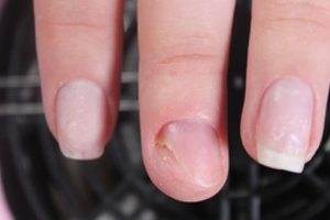 Įspėja moteris: grožio salone galima užsikrėsti grėsminga liga