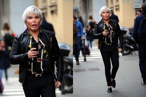 Bėdų dėl plyšusio smakro implanto turintis gyvasis Kenas dėmesį kaustė Milane