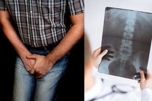 Vyras manė, kad jam sėklidžių vėžys, bet skausmo priežastis nustebino