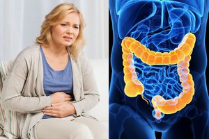 Moteris dėl nemalonių simptomų kaltino kavą, o paaiškėjo, kad jai vėžys