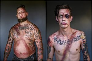 Šiurpiose nuotraukose įamžintos žaizdos atskleidžia svarbią žinią