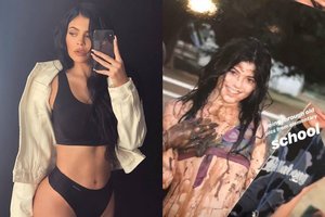 Jauniausia pasaulio milijardierė Kylie Jenner parodė, kaip atrodė prieš grožio injekcijas