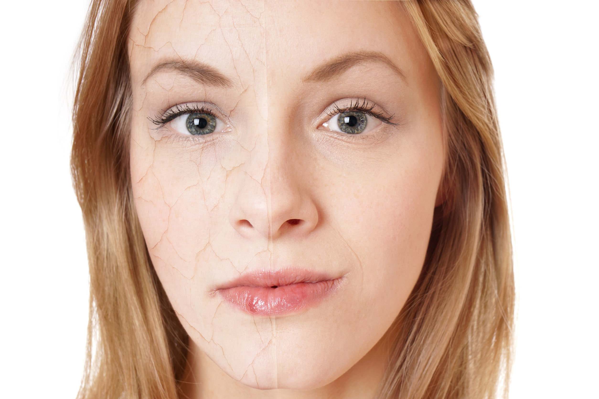 Sausos oda priežiūra – daugiau dėmesio, priežiūros ir rūpesčio – tą puikiai žino turintieji sausą odą.123rf nuotr.